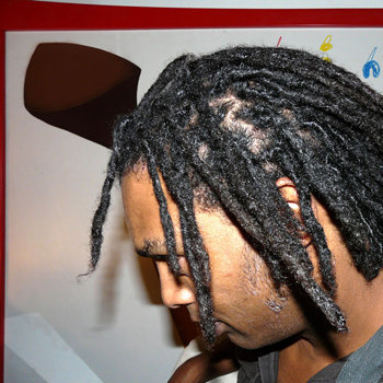 Dreadlocks de Karl