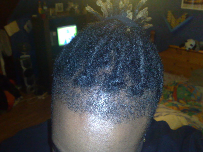 Dreadlocks