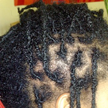Dreadlocks