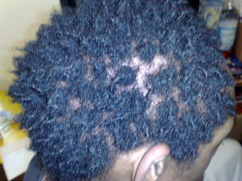 Dreadlocks