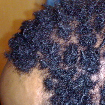 Dreadlocks