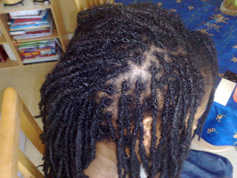 Dreadlocks