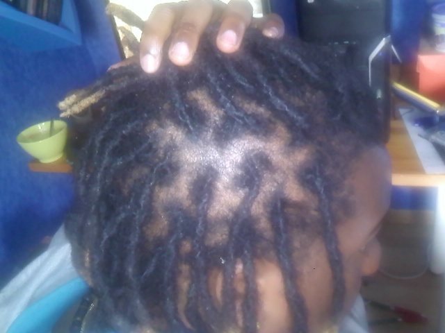 Dreadlocks