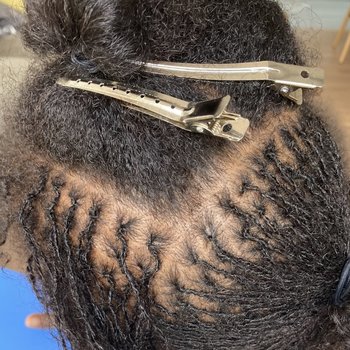 Installation de microlocks 