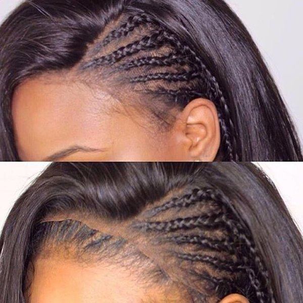 Lace wig