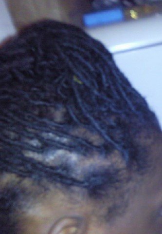 LOCKS