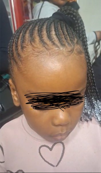 Nattes collées sur enfant
