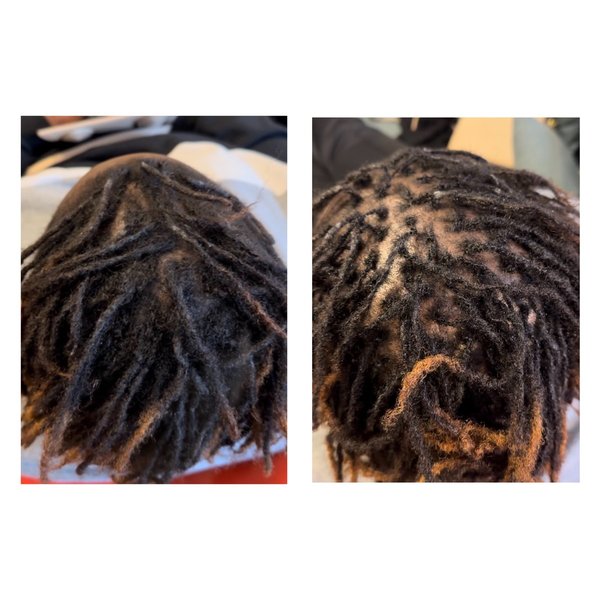 Resserrage / reprise microlocks