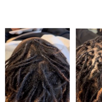 Resserrage / reprise microlocks
