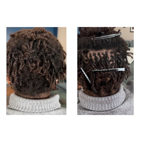 Resserrage / reprise microlocks