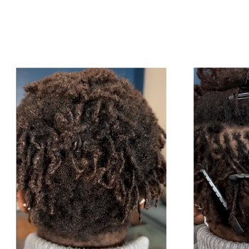Resserrage / reprise microlocks