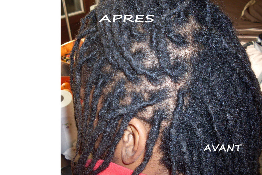 RETOUCHES DREADLOCKS AU CROCHET