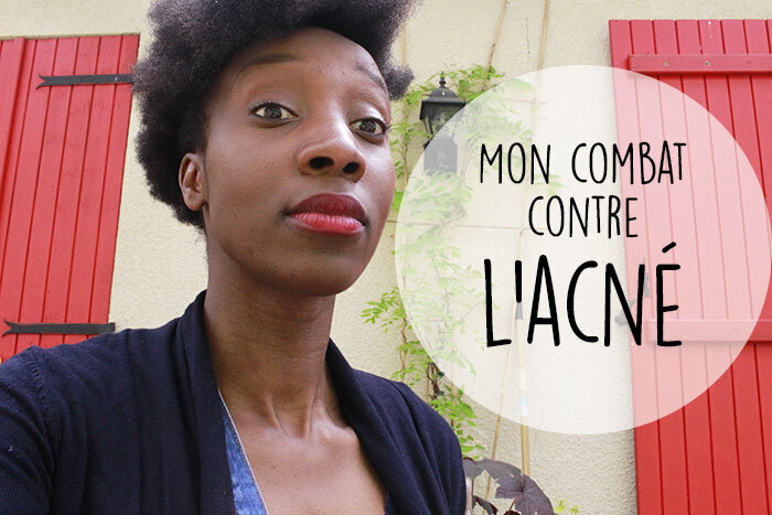 acne peaux noires